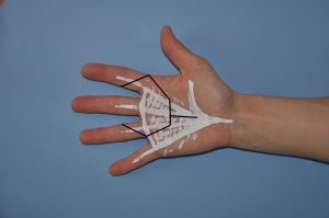 Bild 3: möglicher Zugang bei mehreren Fingern